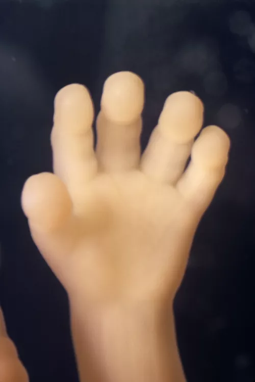 Hand 12 wks 1